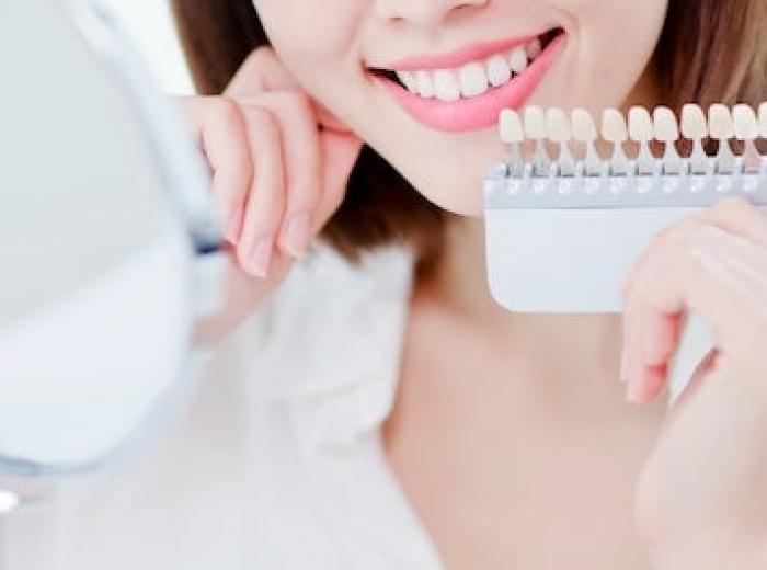 Are Dental Veneers Right for You?