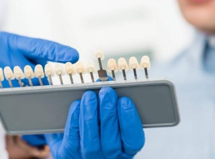 Choosing the Right Dental Implant Restoration Option for Your Needs