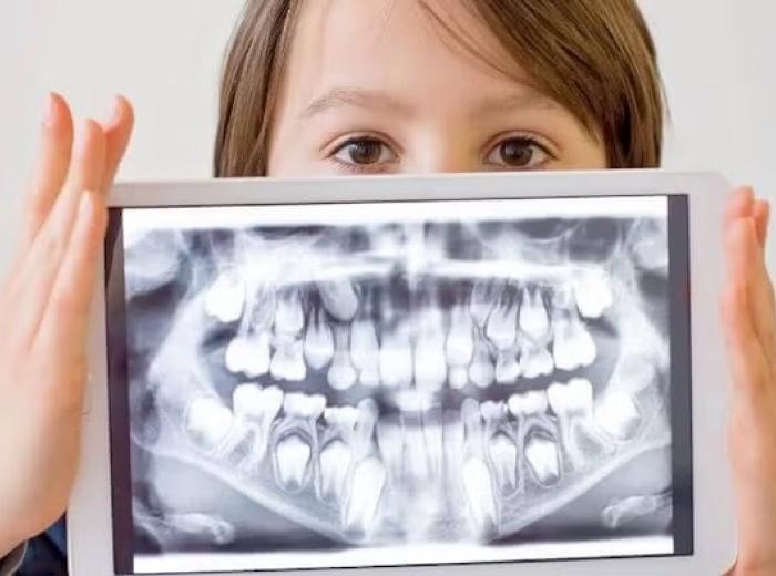 Dental X-Rays: 7 of Your Top Questions, Answered!