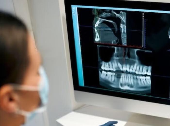Dental X-Rays: The 4 Different Types and Their Use