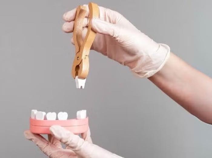 Do You Need a Bone Graft After a Tooth Extraction? What You Need to Know