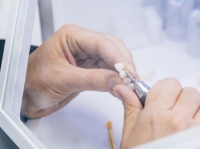 Common Issues Addressed by Restorative Dentistry: From Cavities to Missing Teeth