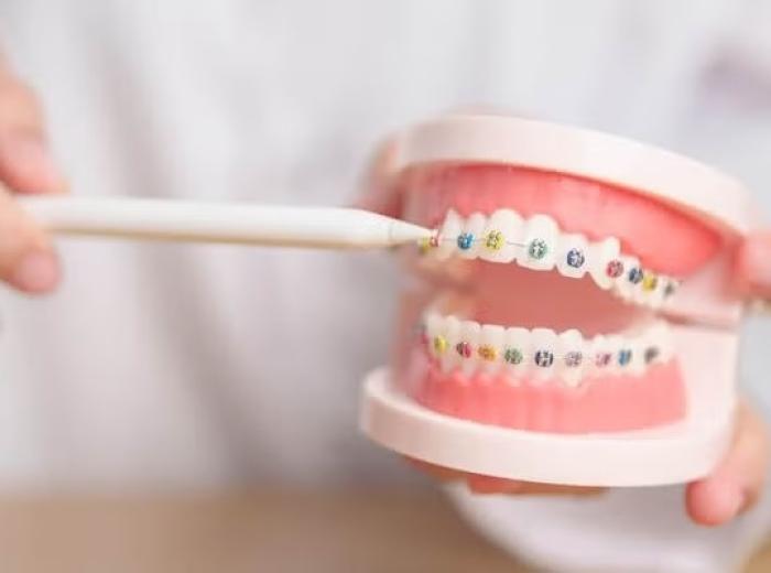 Transform Your Smile: A Comprehensive Look at Orthodontic Care