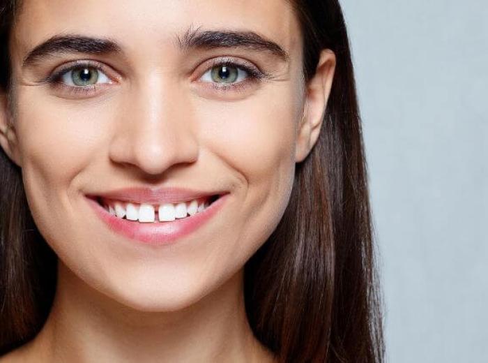 Why Are My Teeth Shifting? 4 Common Causes of Changes in Your Smile