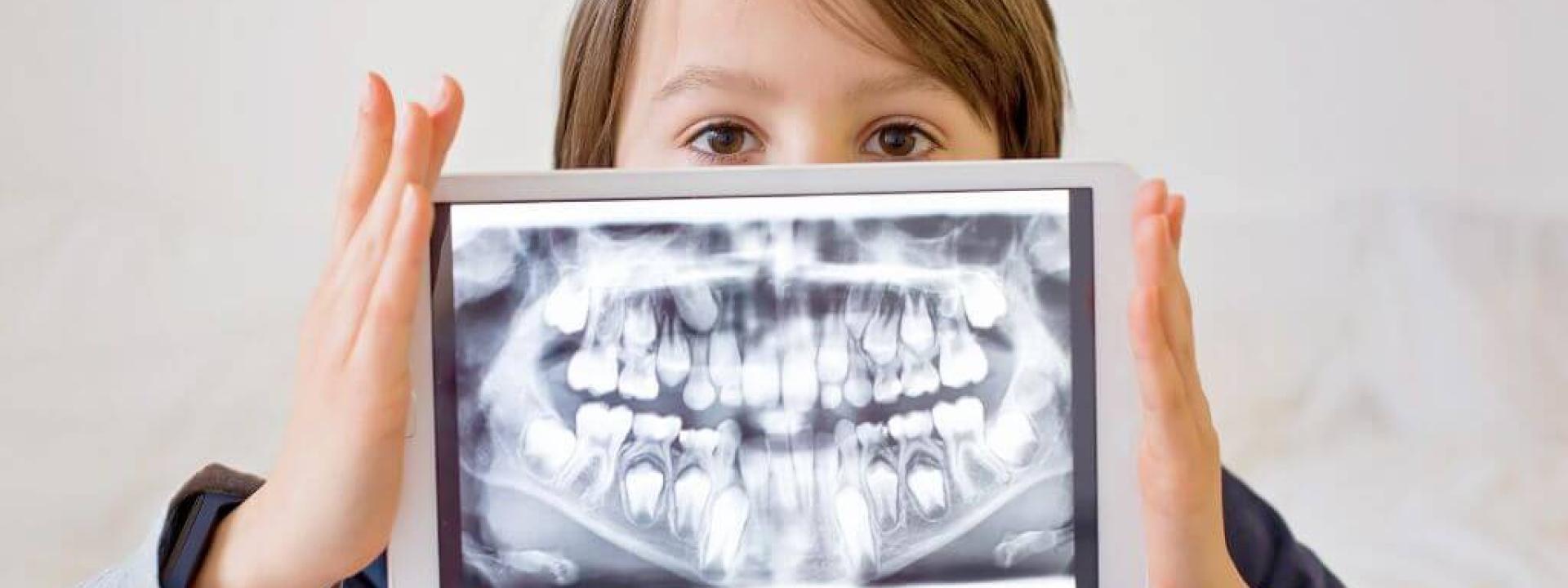 Dental X-Rays: 7 of Your Top Questions, Answered!