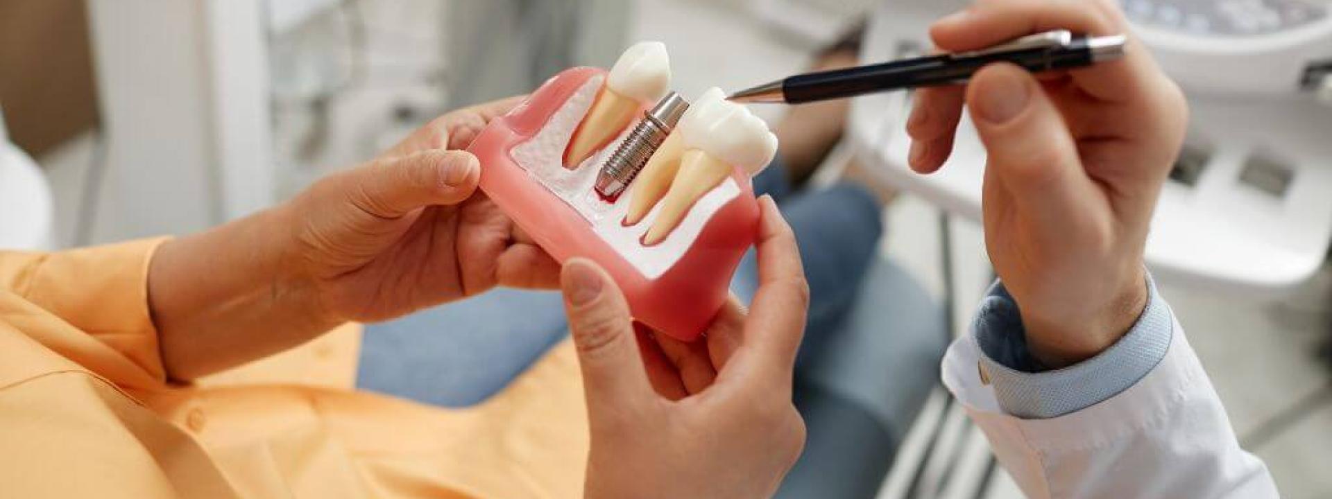 Dentures vs. Implants: Exploring Options for Full Arch Restoration