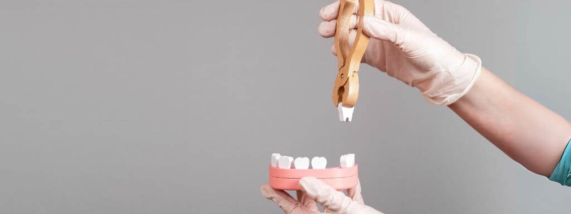 Do You Need a Bone Graft After a Tooth Extraction? What You Need to Know